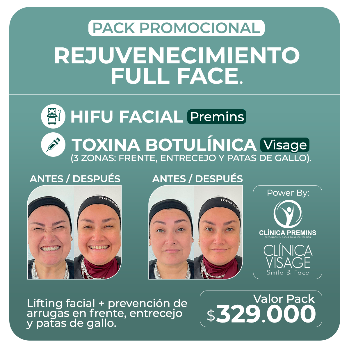 Rejuvenecimiento Full Face
