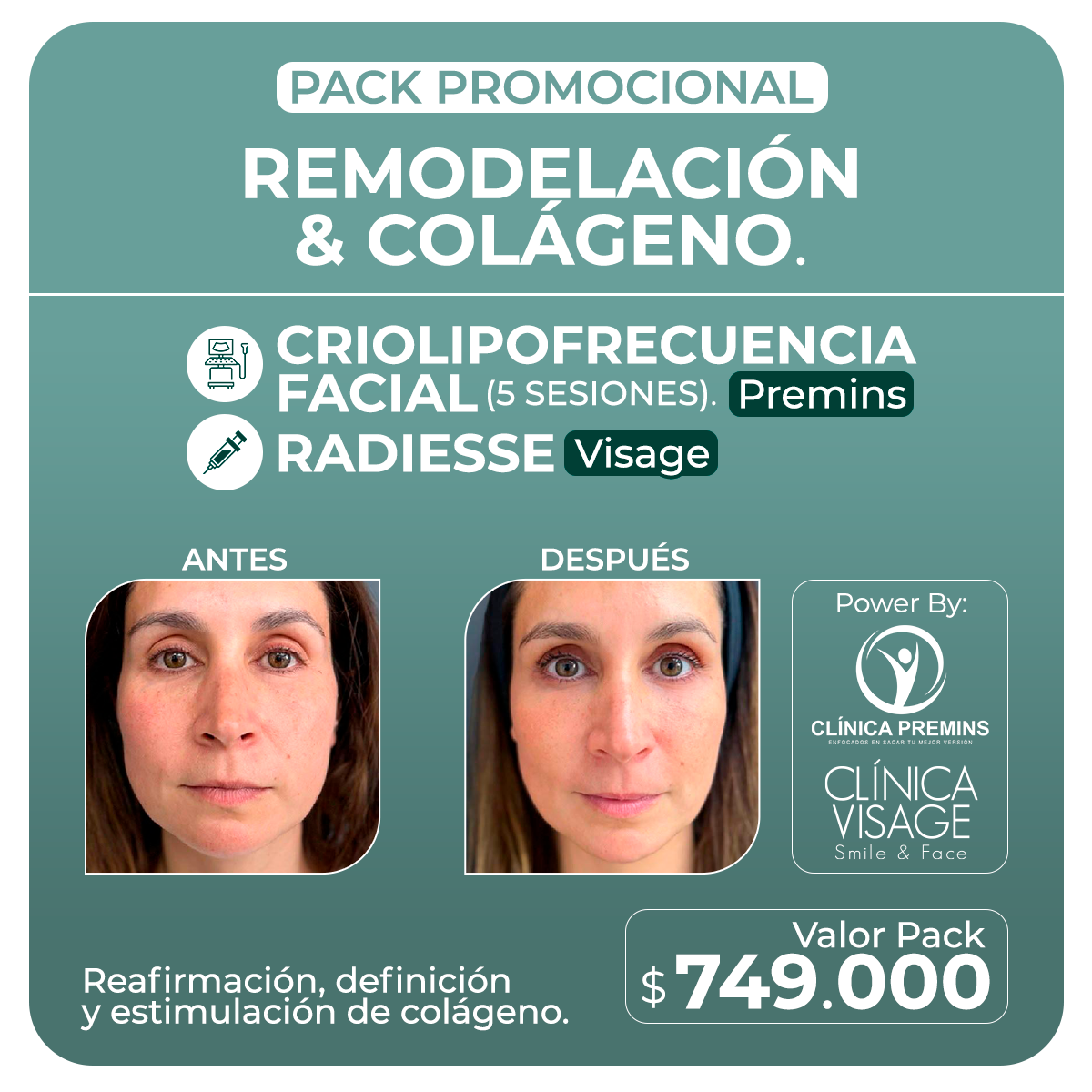 Remodelación y Colágeno